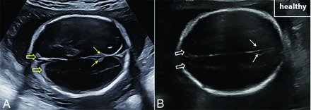 FIG 4.