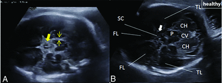 FIG 5.