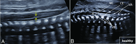 FIG 6.