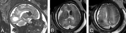 FIG 2.