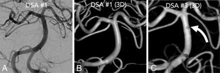 FIG 1.