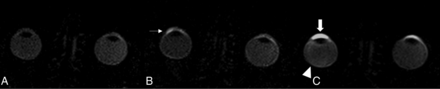 FIG 3.