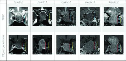 FIG 2.