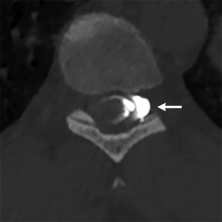 FIG 2.