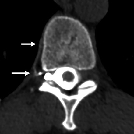 FIG 3.