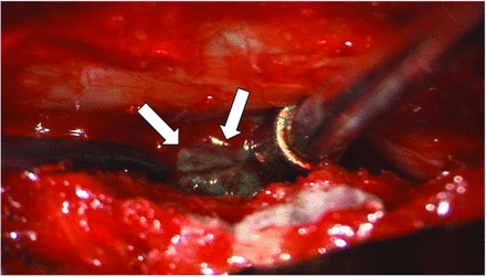FIG 4.