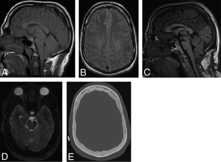 FIG 5.