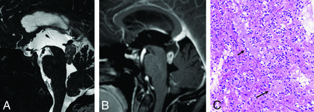 FIG 4.