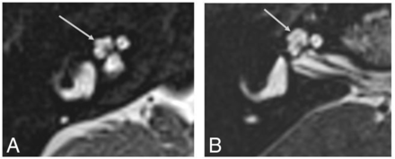 FIG 3.
