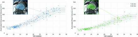 FIG 4.