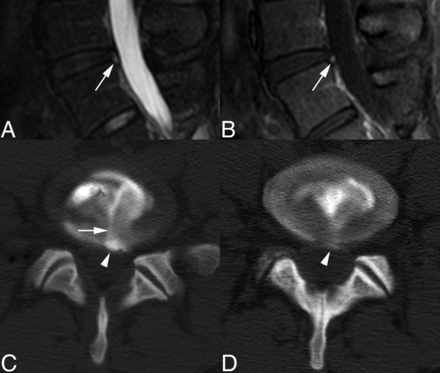 FIG 4.