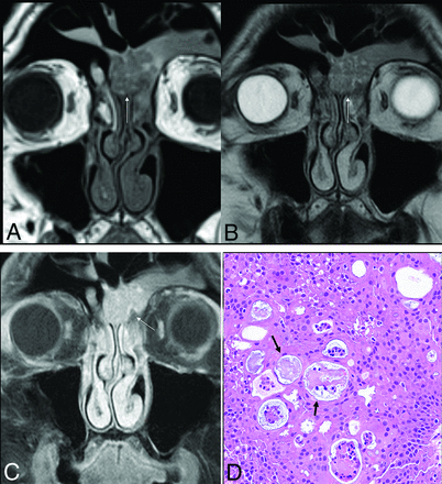 FIG 4.