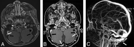 FIG 1.