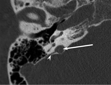 FIG 3.