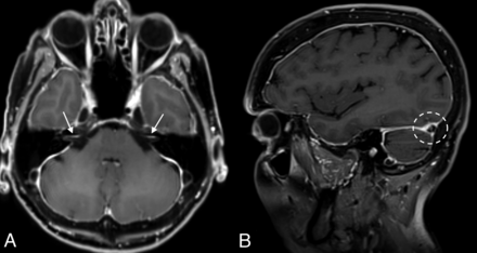 FIG 2.