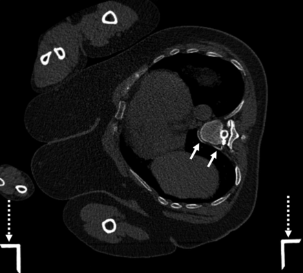 FIG 4.