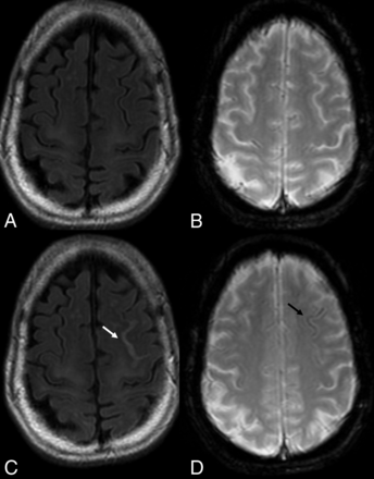 FIG 5.