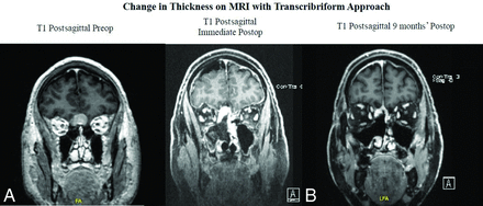 FIG 4.