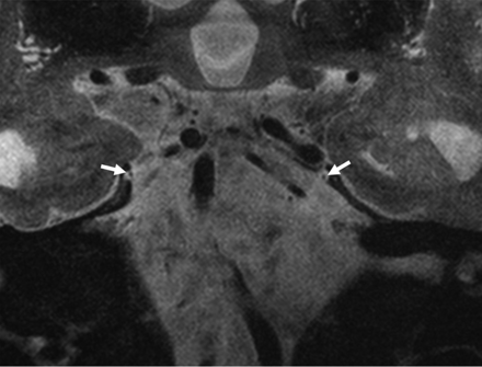 FIG 4.