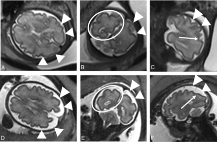 FIG 3.