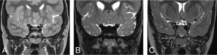 FIG 1.