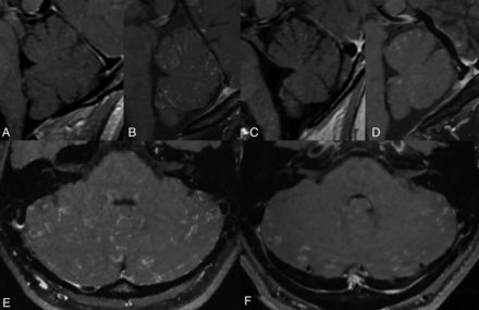 FIG 2.