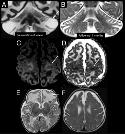 FIG 2.