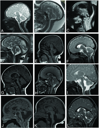 FIG 2.