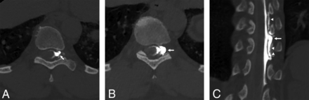 FIG 4.