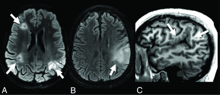 FIG 2.