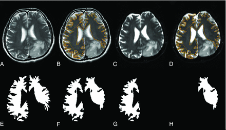 FIG 2.