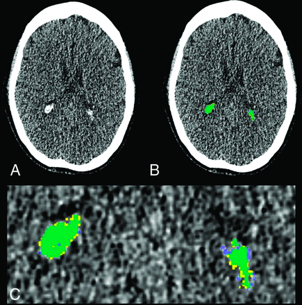 FIG 1.