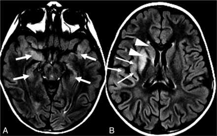 FIG 4.