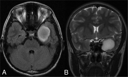 FIG 1.