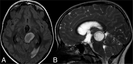 FIG 2.