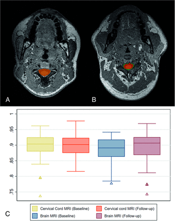 FIG 2.