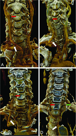 FIG 3.