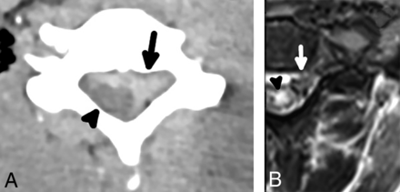 FIG 5.