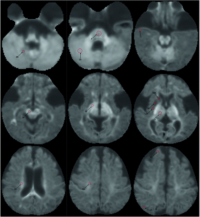 Fig 2.