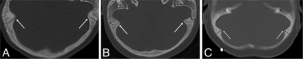FIG 2.