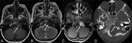 FIG 6.