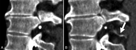 FIG 2.