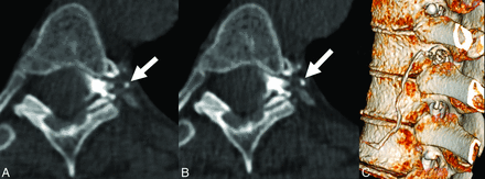 FIG 3.
