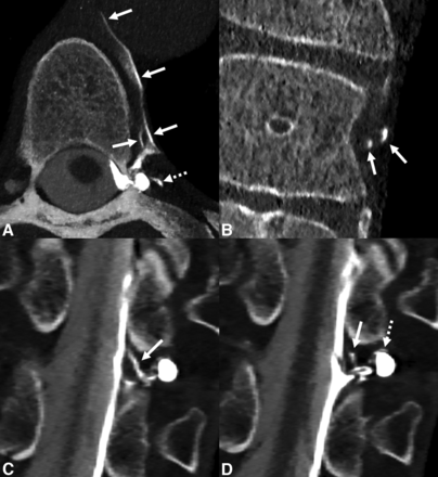 FIG 4.