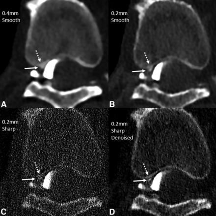 FIG 6.