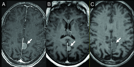 FIG 3.