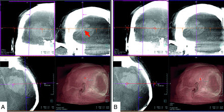 FIG 1.
