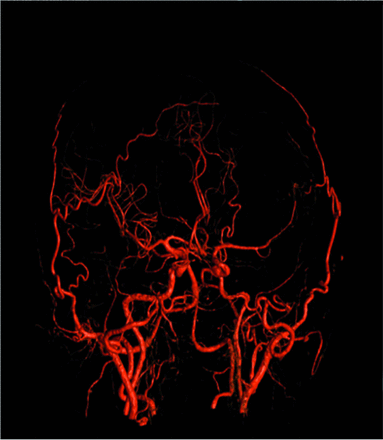 FIG 4.