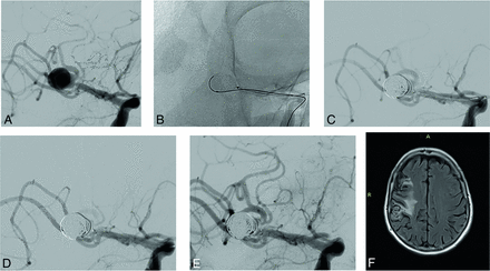 FIG 2.