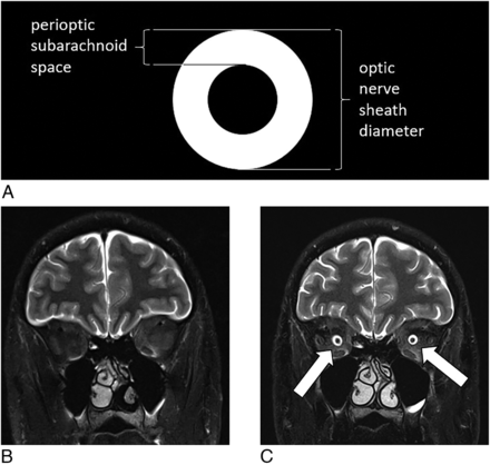 FIG 1.